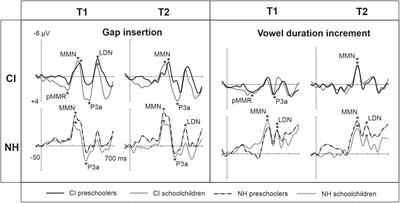 The development of cortical processing of speech differs between children with cochlear implants and normal hearing and changes with parental singing